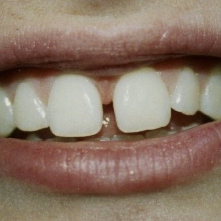 Article 1